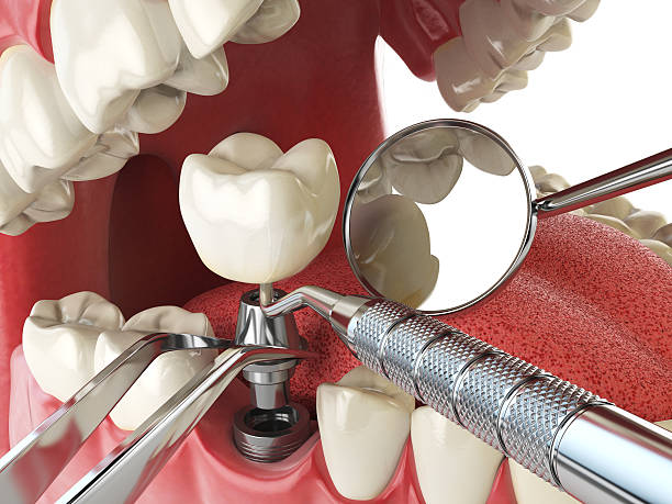Best Same-Day Emergency Dentist in Twin City, GA